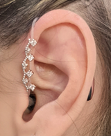 aparelho-auditivo-personalizado